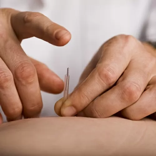 dry-needling-Helio-KC-Physical-Therapy-Overland-Park-KS